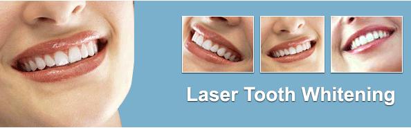 lasersmile beirut lebanon