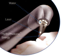 operative-laser-dentistry