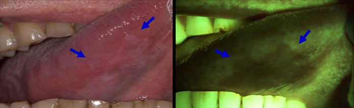 oral-pathology-diagnosis