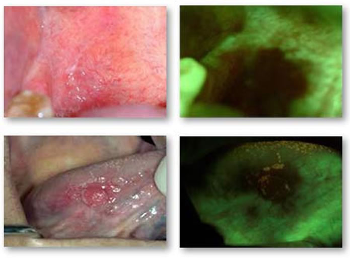 oral-pathology-diagnosis