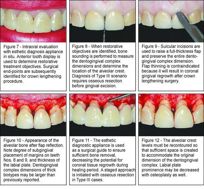 oral-surgery aesthetic-surgery