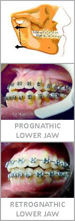 orthodontic-surgery