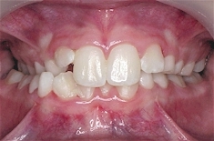 orthodontics-diagnosis12