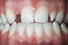 orthodontics-diagnosis13