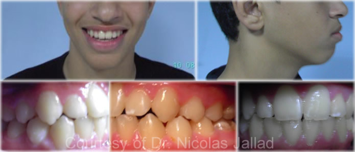 orthodontics-diagnosis