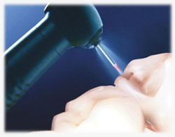 pediatric-laser-dentistry