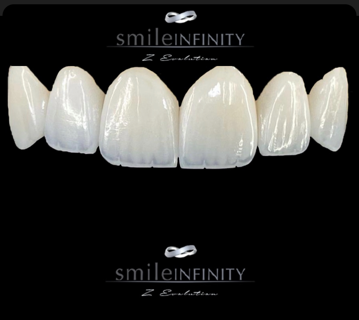 ZEvolution Veneers ceramic shells no-prep porcelain veneers Smile Infinity Ferrari Dental Clinic Beirut Lebanon